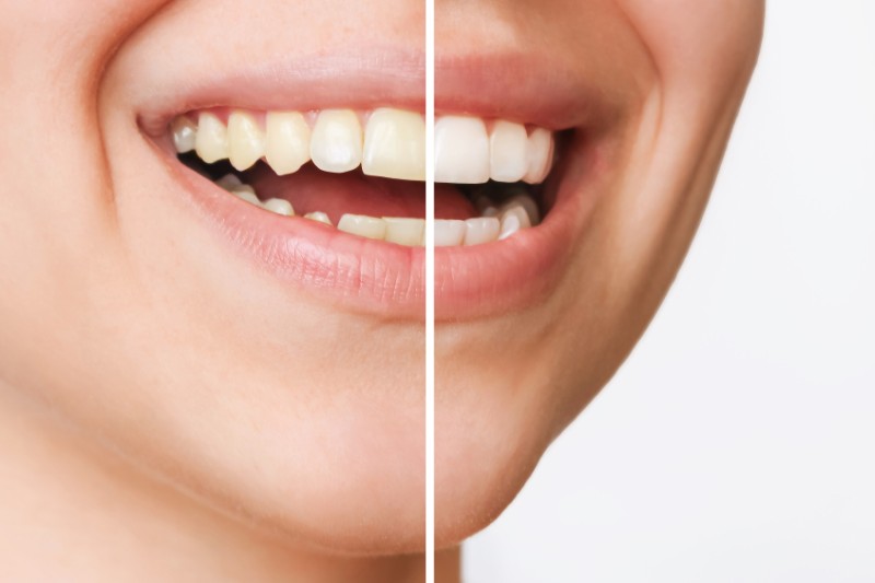 before-after-3